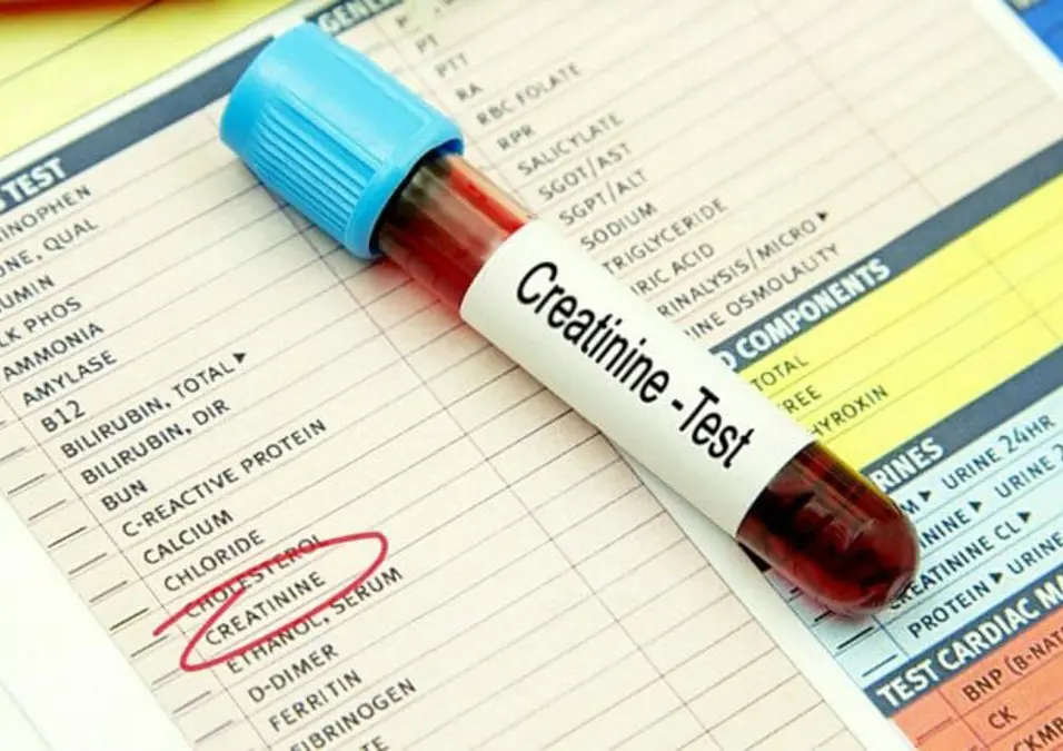 تحليل الكرياتين